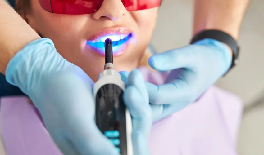 تبييض الاسنان بالليزر