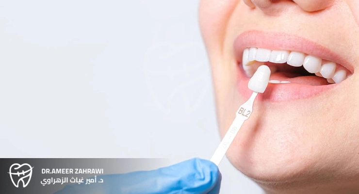 ما هو اللومينير