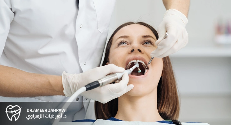 الوقاية من جير الأسنان و الرواسب