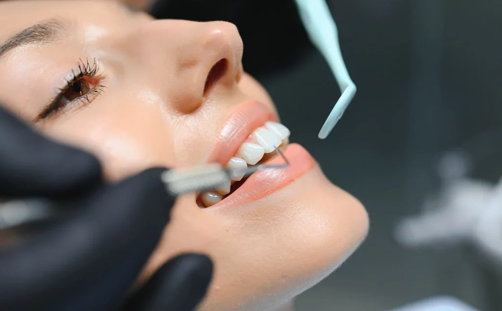 تركيب أسنان الزيركون