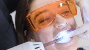 أفضل دكتور تبييض أسنان في جدة