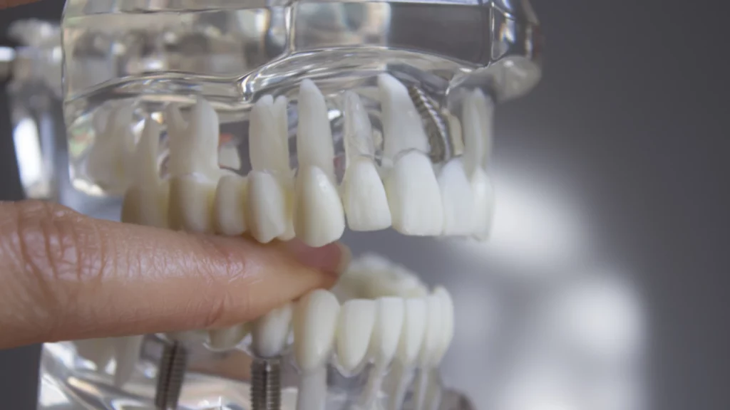 أفضل دكتور تركيبات أسنان في جدة