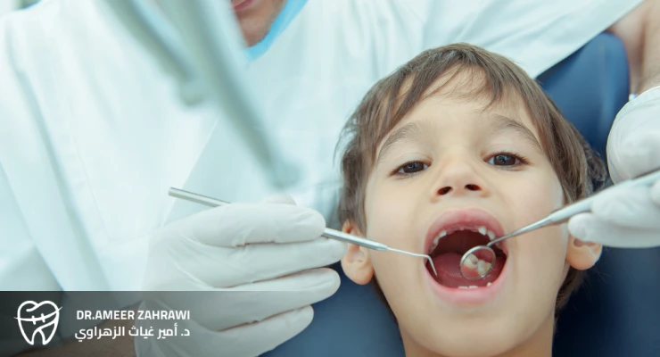 أفضل دكتور أسنان أطفال في جدة