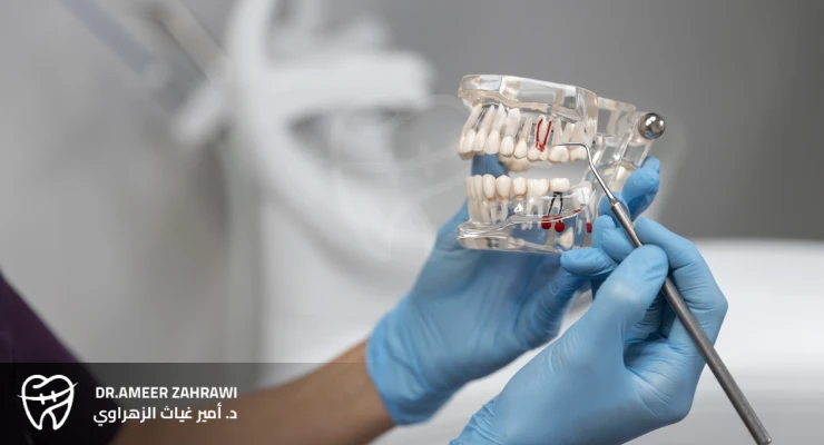 خدمات زراعة الأسنان