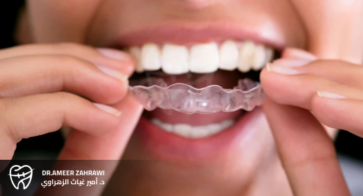 كيفية التخلص من طحن الأسنان 