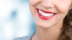 تجميل أسنان