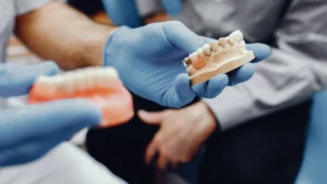 زراعة أسنان