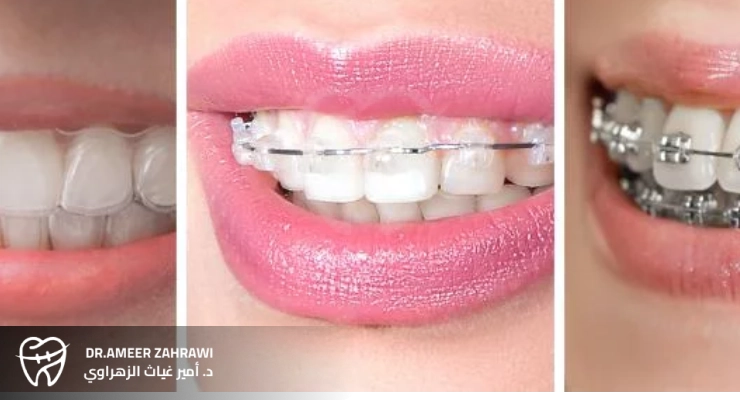 التكلفة: أيهما أوفر على المدى الطويل؟