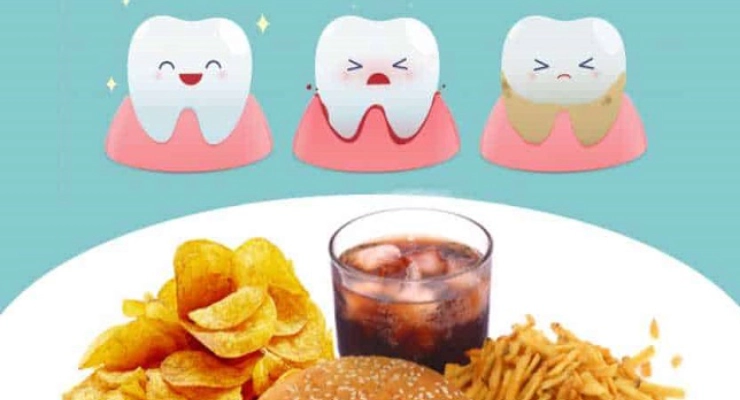 أطعمة تضعف الأسنان وتسبب التسوس