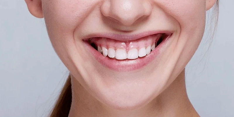 مدة العلاج والتعافي بعد استعادة الأسنان الأمامية