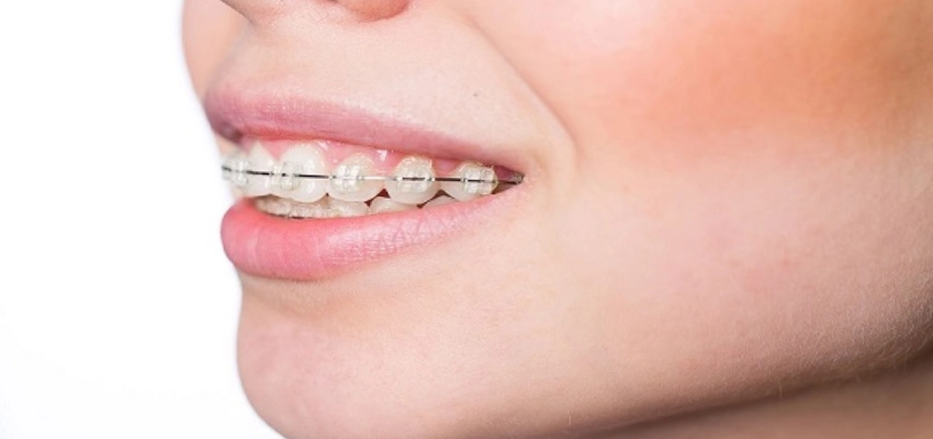 العضة العميقة