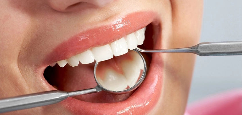 الفحص الدوري للأسنان