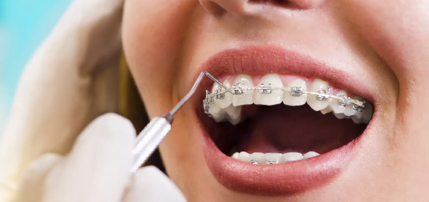 الأطعمة والعادات التي يجب تجنبها للحفاظ على النتائج