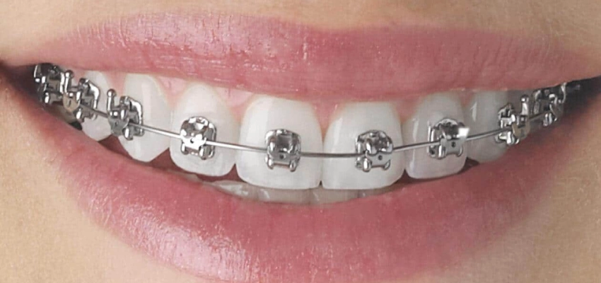 كيف تساعدك المتابعة المبكرة على تصحيح أي مشكلة صغيرة؟