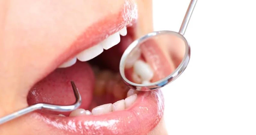 Modern Medical Solutions for Treating Dry Mouth