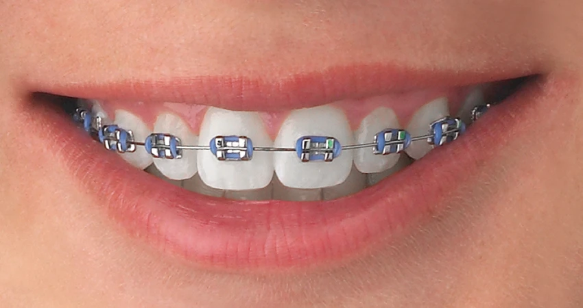 The Role of Treatment Duration and Follow‑Up Visits in Determining Cost