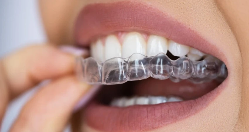 How to Choose the Best Orthodontist?