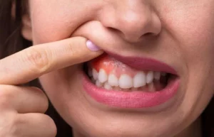 Gum Relocation: Causes, Types, Surgery, and Laser | A Comprehensive Guide 2026 with Dr. Abeer