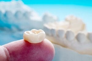 Tooth filling falling out: causes, what to do immediately, and the best treatment methods