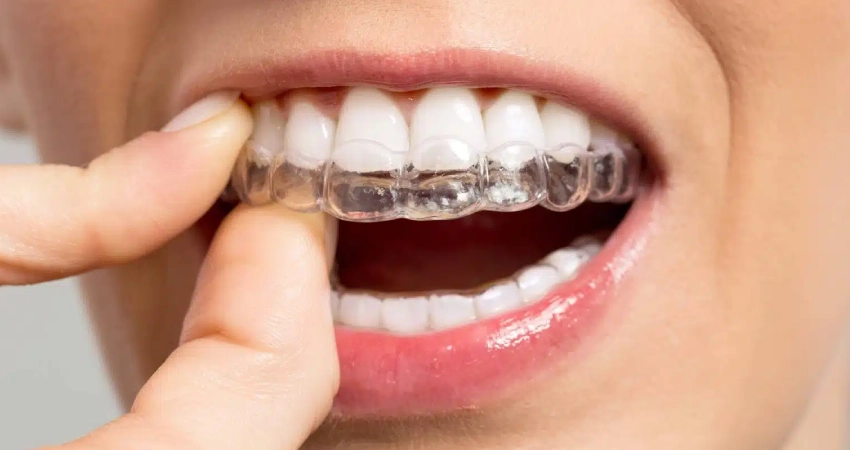 Does Treatment Time Depend on How Complex the Case Is?
